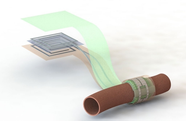 Artist’s depiction of the biodegradable pressure sensor wrapped around a blood vessel with the antenna off to the side (layers are separated to show details of the antenna’s structure).